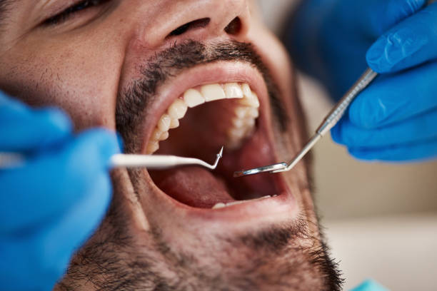 Emergency Dental Services in Cahokia, IL